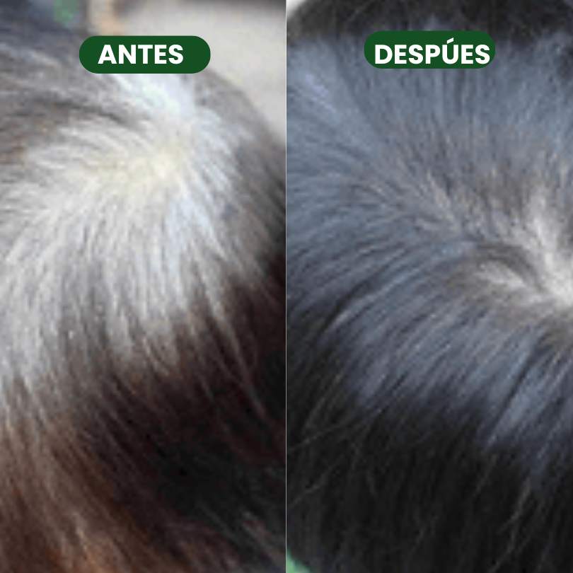 Shampoo y Colágeno para tu cabello. Resultados rápidos y garantizados